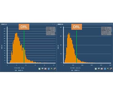 日本における診断参考レベル ― Japan DRLs 2015 ―