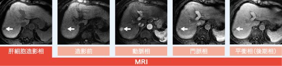 MRIの基本3 MRIの基本3