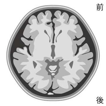 tomogram-img-07