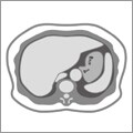 tomogram-thum-10