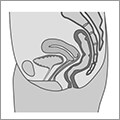 tomogram-img-01