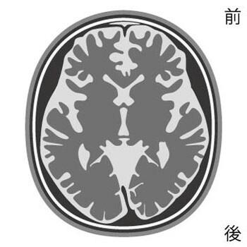 tomographic-img-02