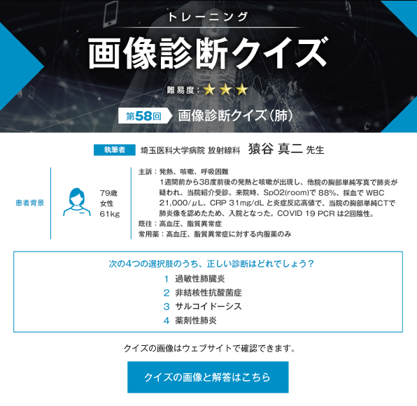 画像診断クイズ（肺）