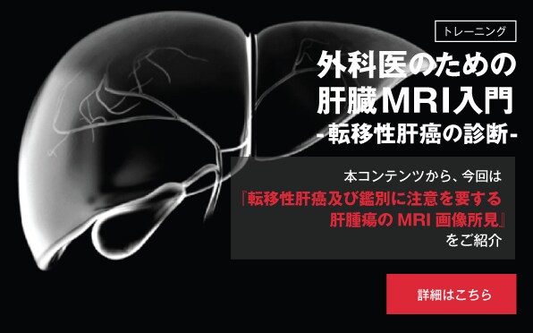 ＜トレーニング＞ 外科医のための肝臓MRI入門 -転移性肝癌の診断-