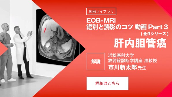 ＜動画ライブラリ＞ EOB-MRI 鑑別と読影のコツ 動画Part3 ・肝内胆管癌  (全9シリーズ)