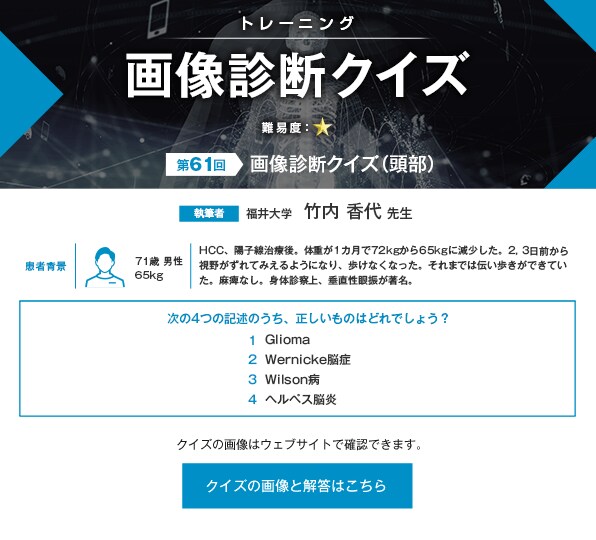 ＜トレーニング＞ 画像診断クイズ（頭部）