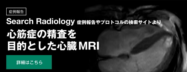 ＜症例報告＞ 心筋症の精査を目的とした心臓MRI