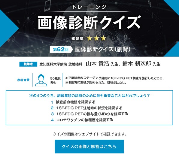画像診断クイズ（副腎）