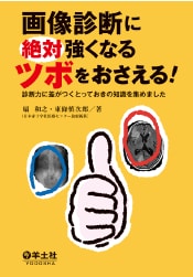画像診断に絶対強くなるツボをおさえる！