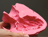 3D Printing 臨床応用への現状と展望