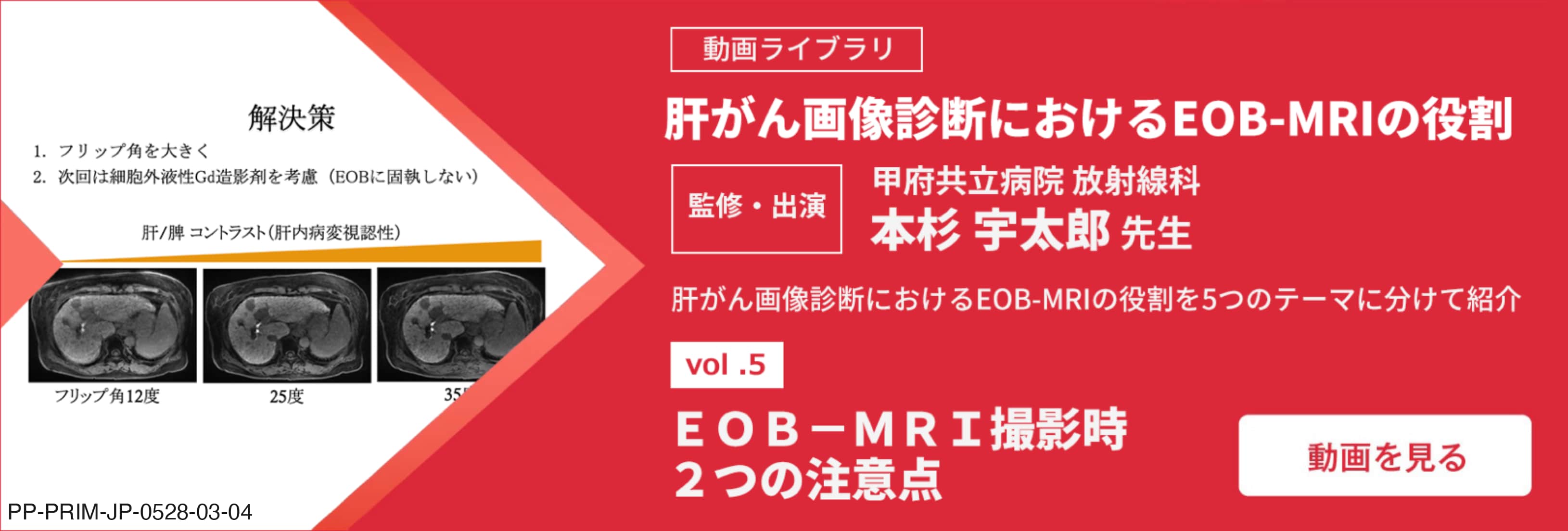 転移性肝癌の診療