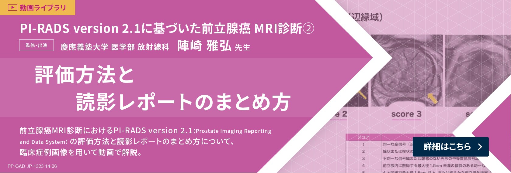 PI-RADS version 2.1に基づいた前立腺癌 MRI診断②