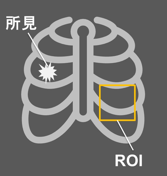 図1 所⾒とは異なる位置にROIを表⽰した例
