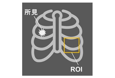 画像診断⽀援AIソフトウェアの性能評価