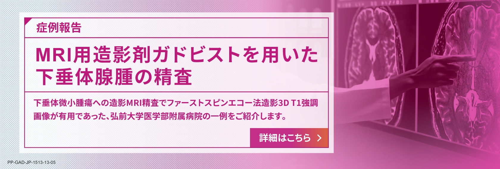 MRI用造影剤ガドビストを用いた下垂体腺腫の精査