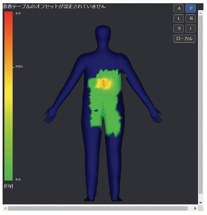 【 Fig.8 】入射皮膚線量マップ表示例