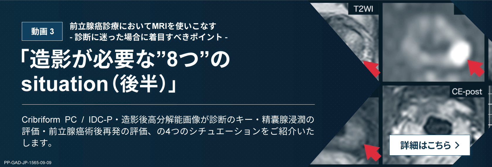 造影が必要な”8 つ”のsituation(後半)