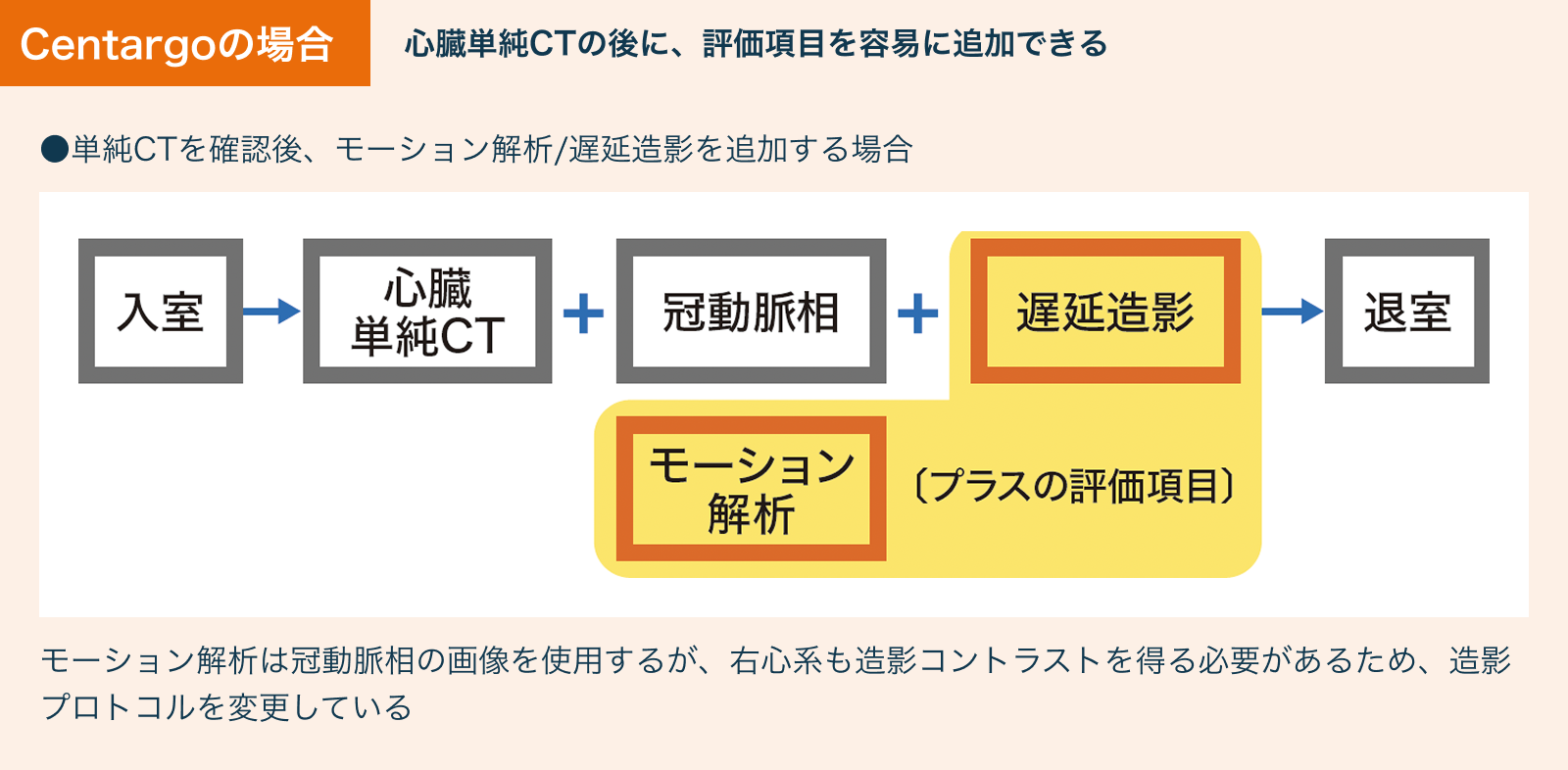 Centargoを用いた場合の心臓CT検査手順
