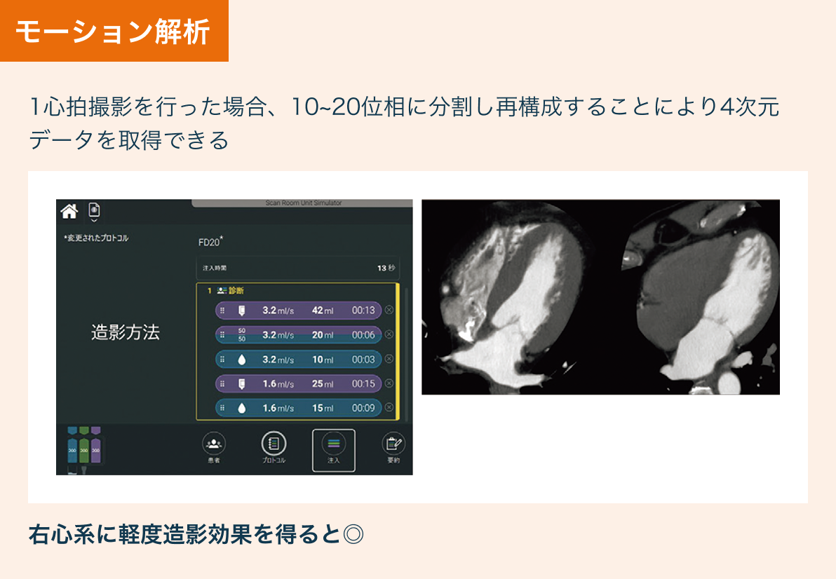 モーション解析の撮影プロトコル