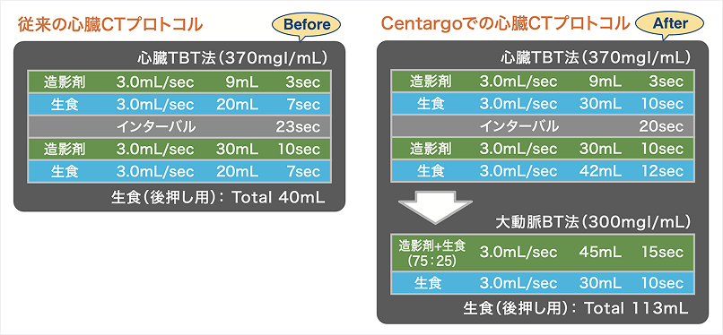 表1 心臓CTプロトコルの比較