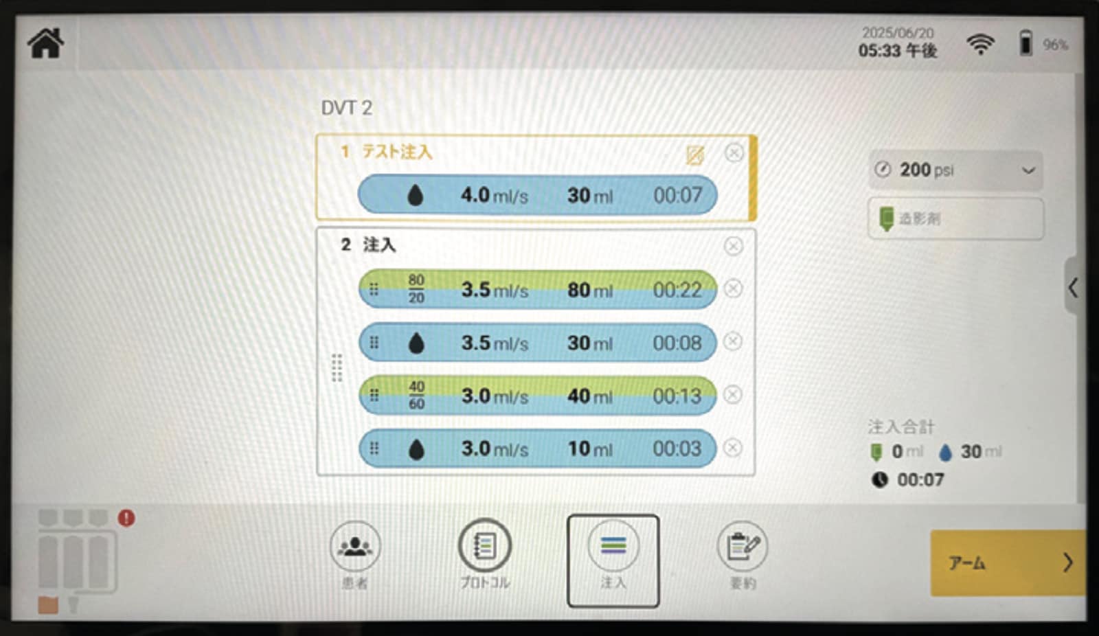 図1 Centargoを用いた同時注入プロトコル(新しい操作室モニター)
