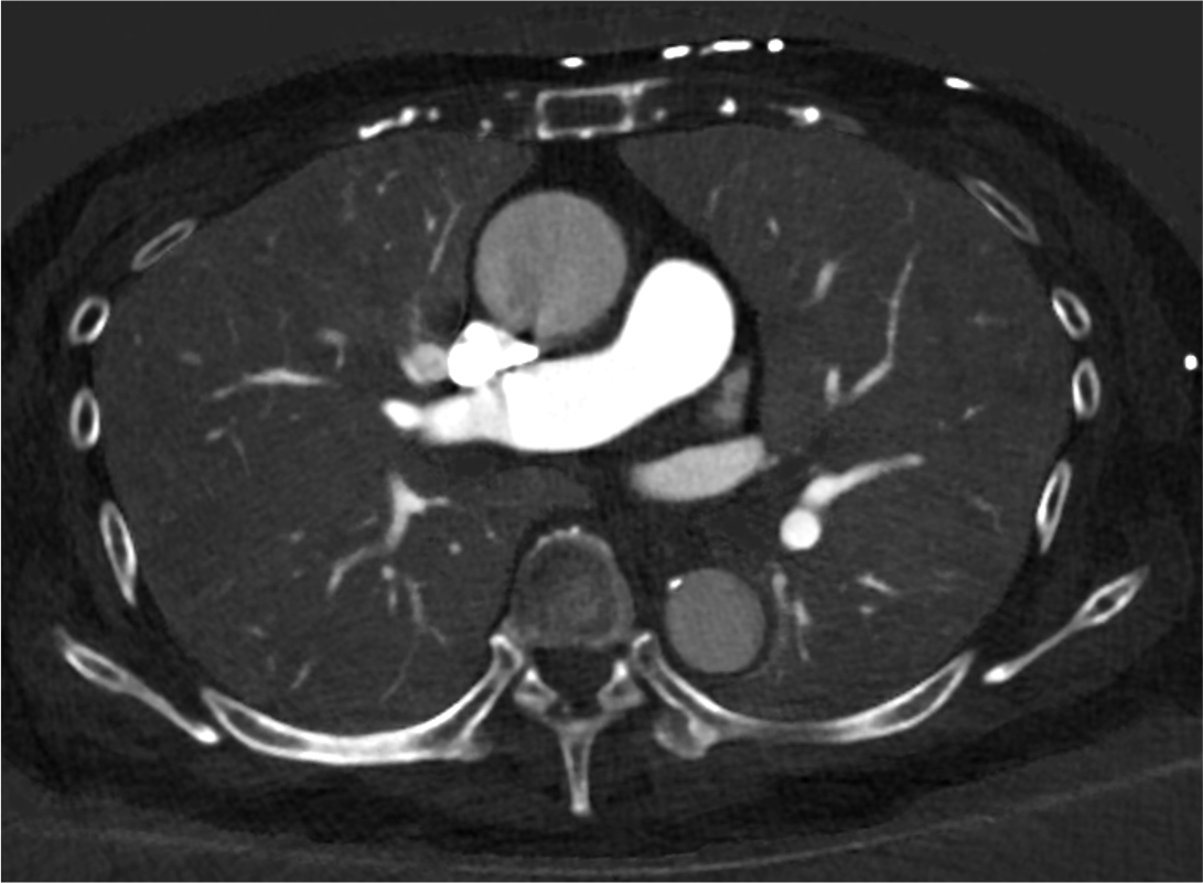 図１．心臓CT（VR)