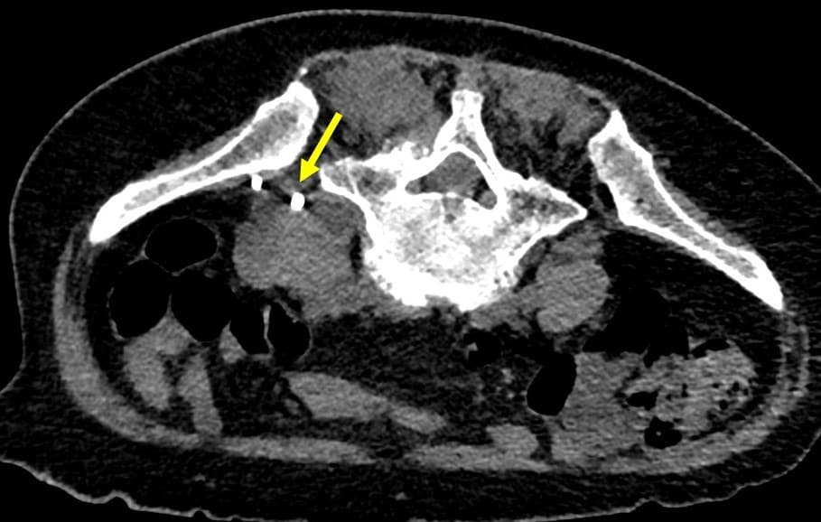図4．単純（腹臥位）