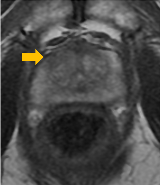図1．T2強調画像