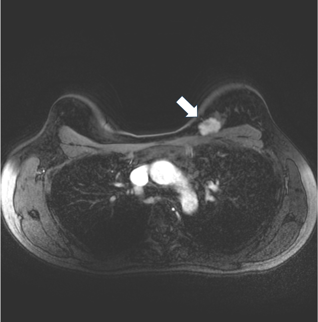 4. Ultrafast DCE (10phase目)