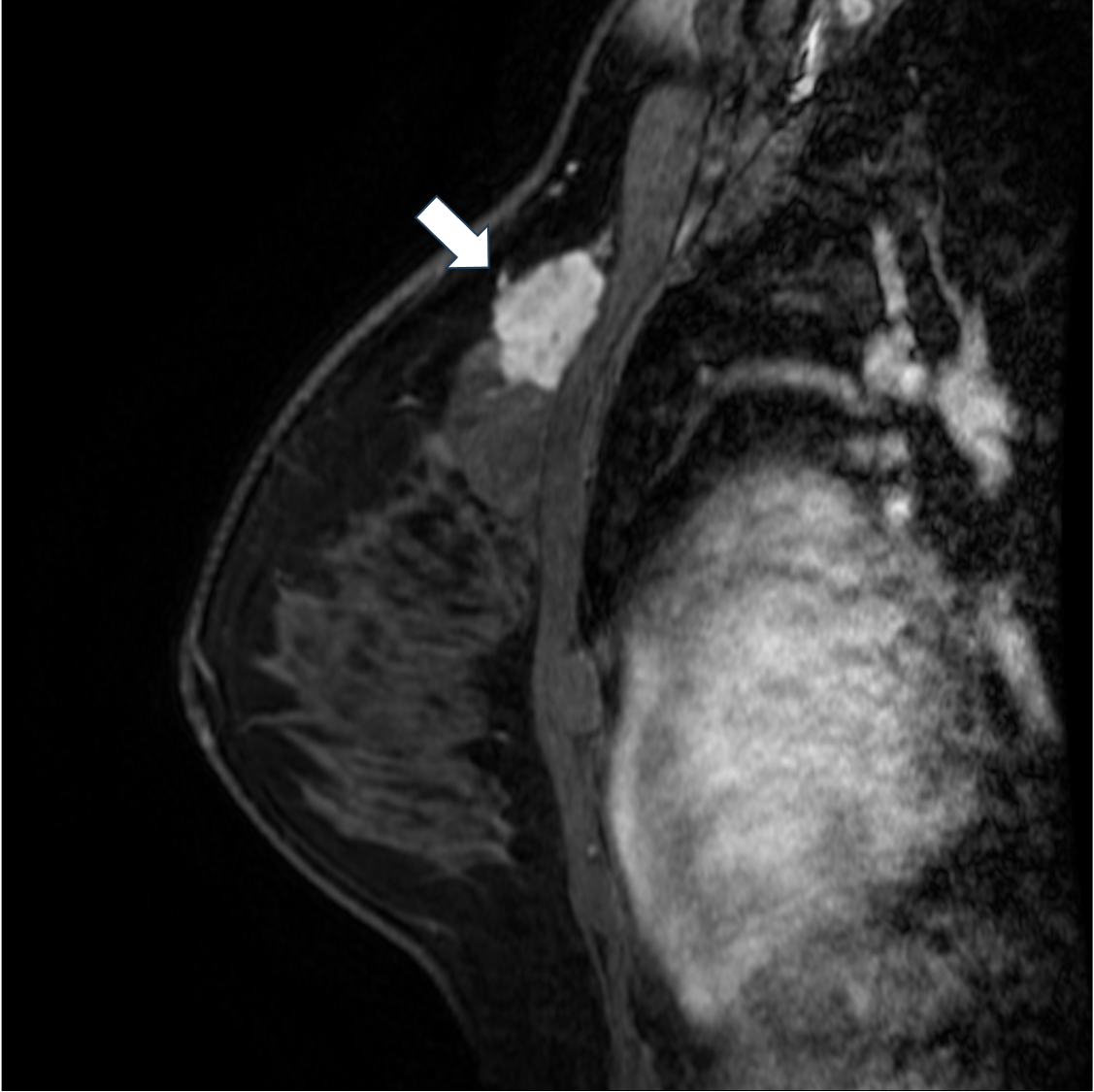 7. 造影後高分解能T1強調画像