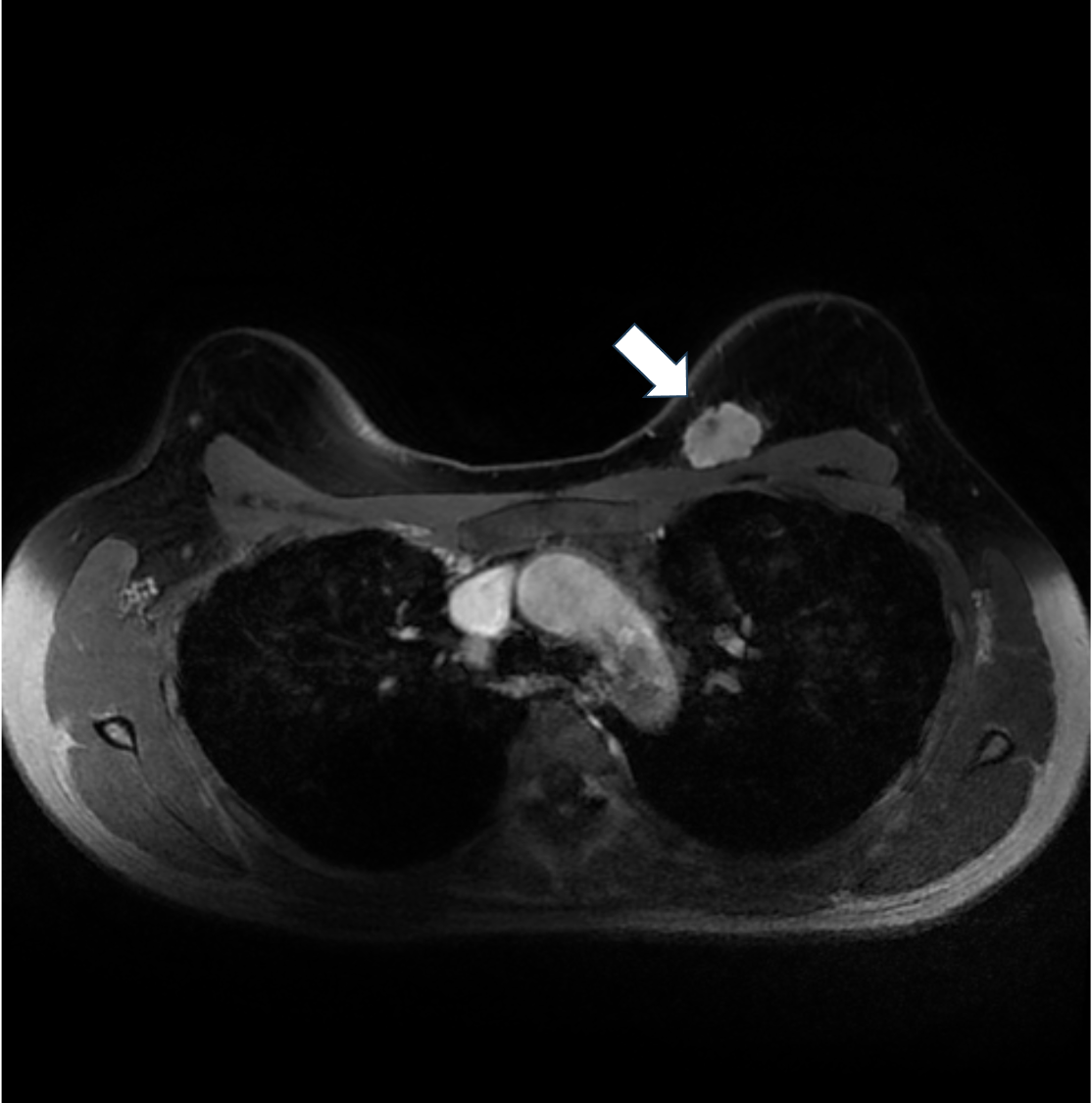 8. ダイナミックMRI　遅延相