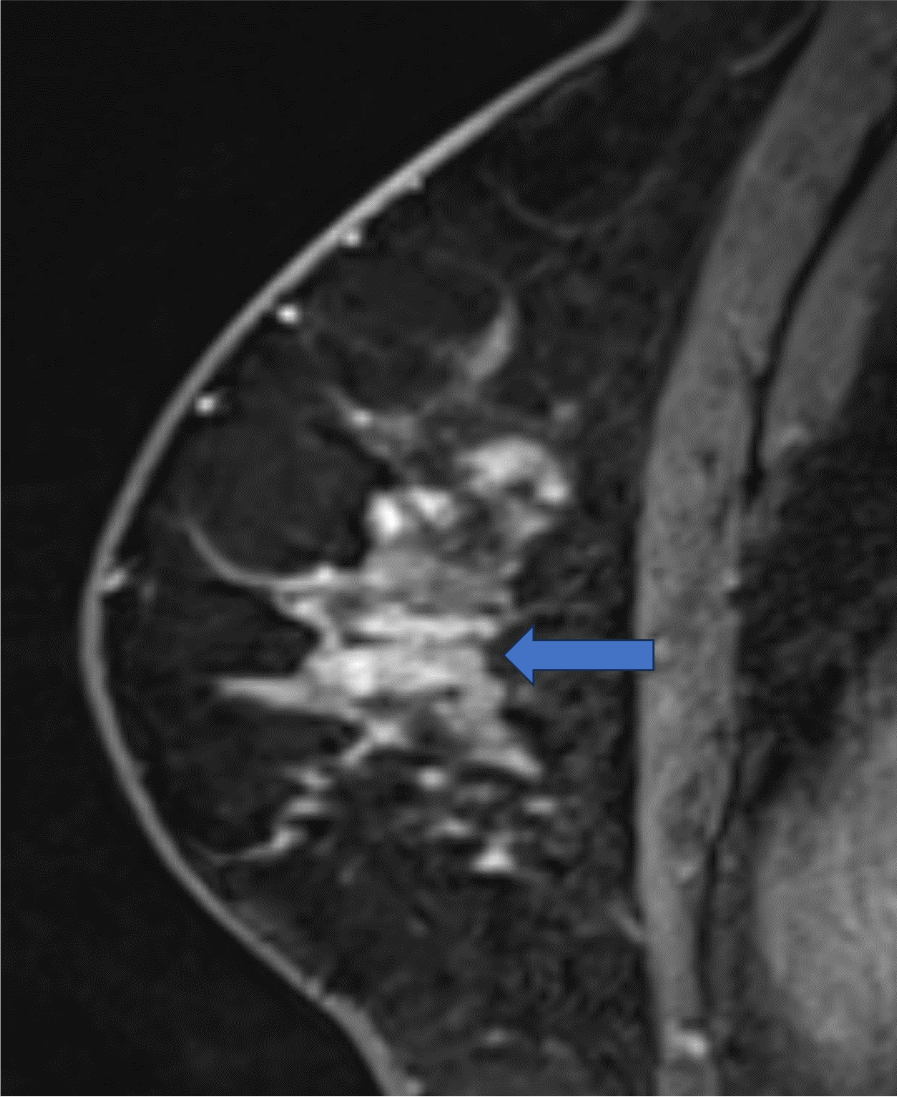 6. 造影後高分解能画像