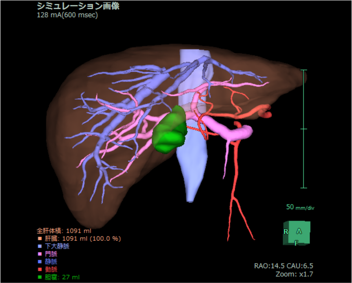 図2．血管再構成画像