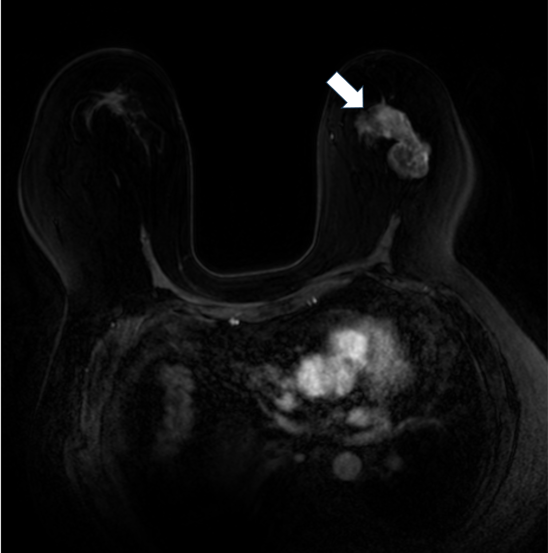 4. Ultrafast DCE (11phase目)
