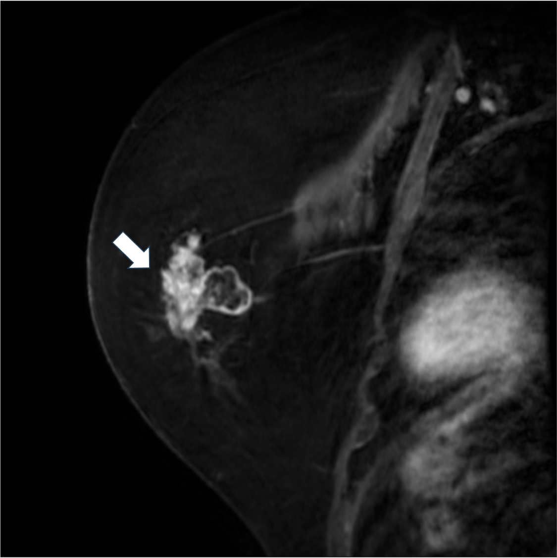 7. 造影後高分解能T1強調画像