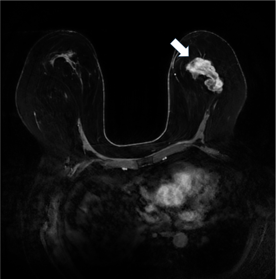 8. ダイナミックMRI　遅延相