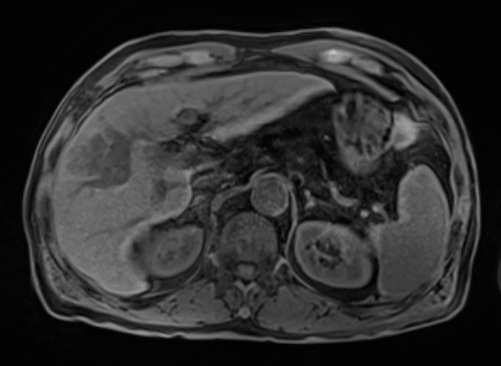 図1．治療前単純
