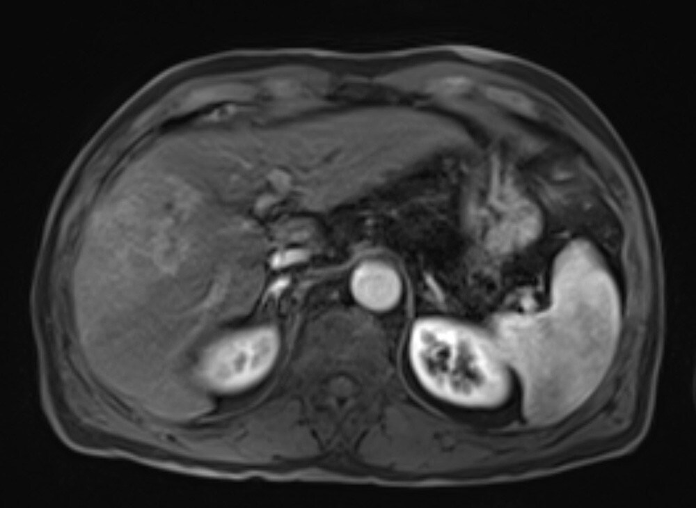 図2．治療前早期相
