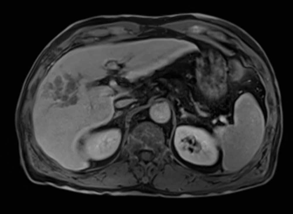 図3．治療前後期相