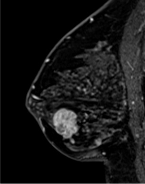 6. 造影後高分解能画像