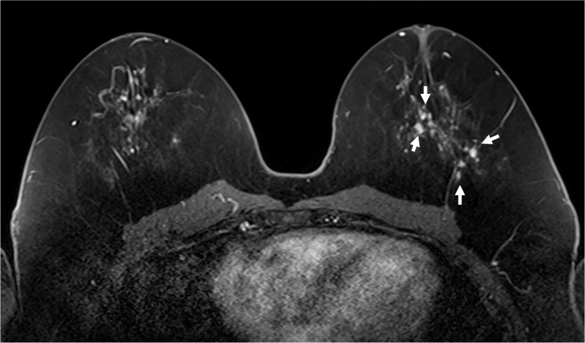  4. ダイナミックMRI (造影前 早期相 遅延相)