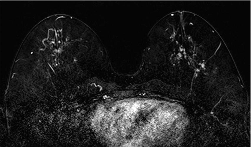  4. ダイナミックMRI (造影前 早期相 遅延相)