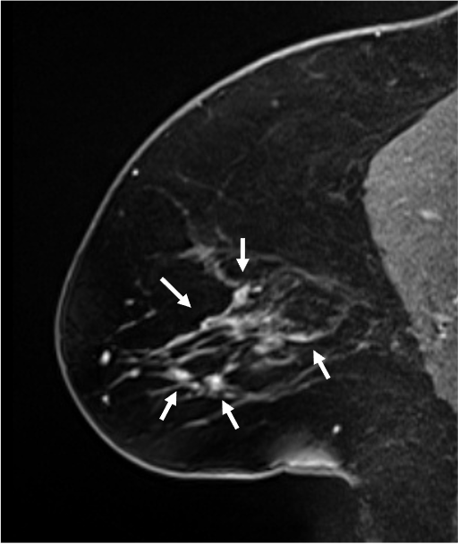  6. 造影後高分解能画像