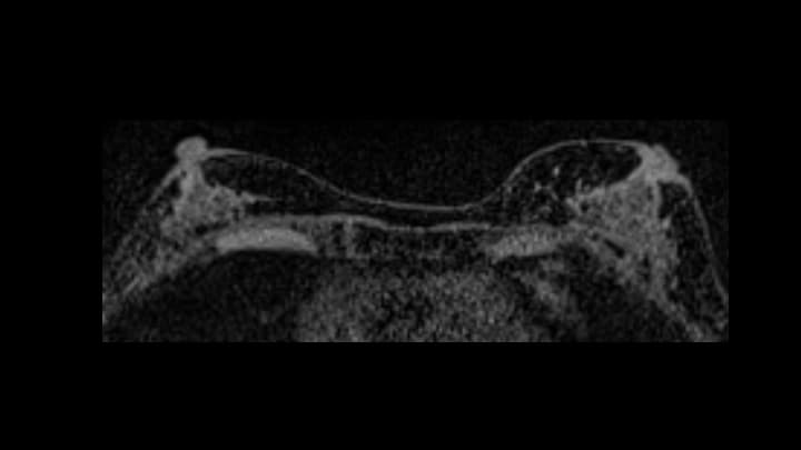 4. ダイナミックMRI（造影前）
