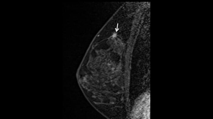 6. 造影後高分解能T1強調画像