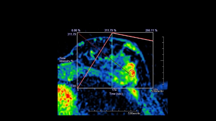 7. Time intensity curve