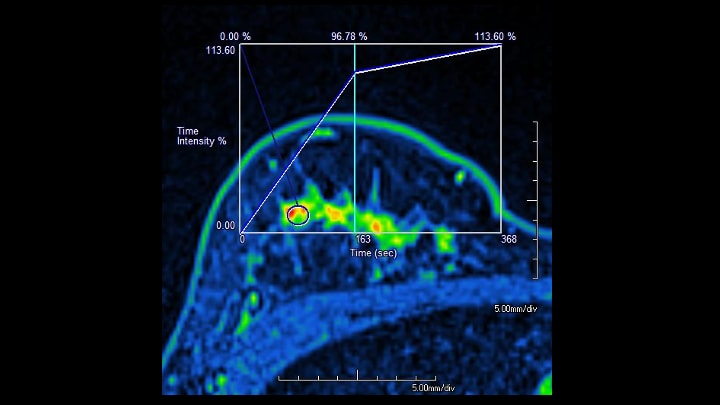 7. Time intensity curve