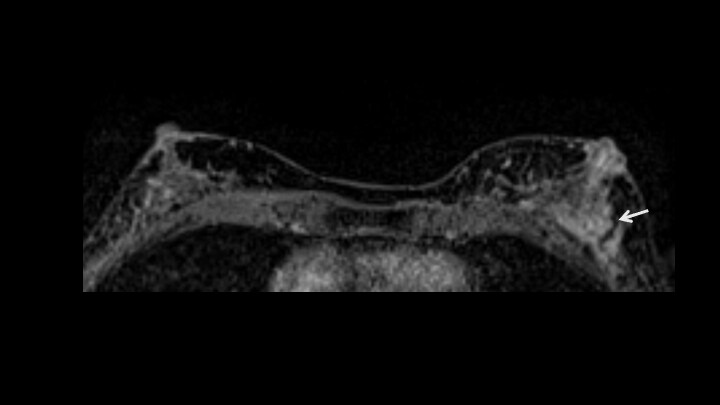 8. ダイナミックMRI　後期相