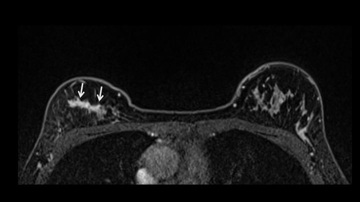 8. ダイナミックMRI　後期相