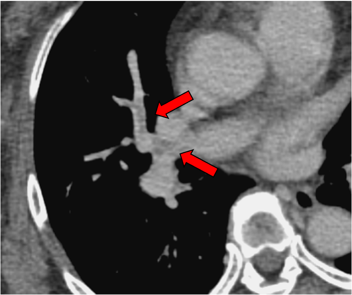 図１．門脈相 120kVp画像
